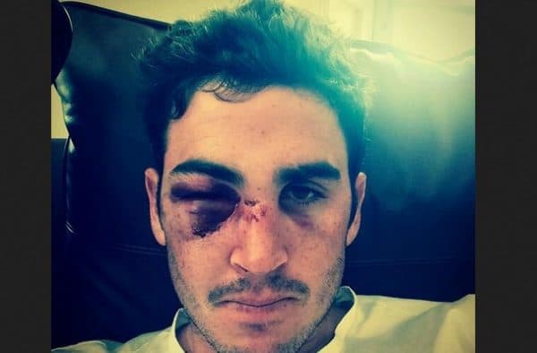 Craig Kieswetter